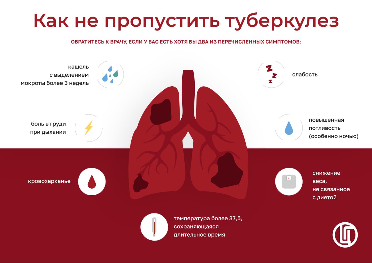 Тюменцам рассказали о первых признаках туберкулеза